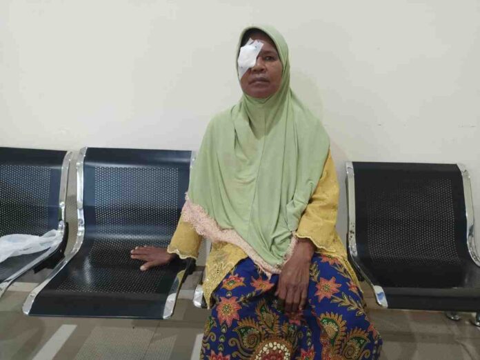 warga kangean operasi mata